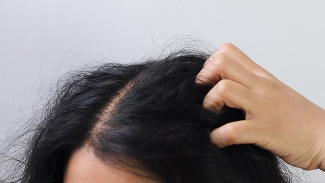 Woman has itchy scalp and hair loss
