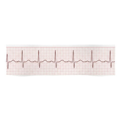 Ecg heartbeat tracing on graph paper with regular sinus rhythm pattern transparent PNG