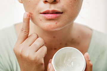 A young Asian woman reflecting on mirror ready for skincare treatment, with her right finger...