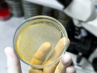 Colony of Burkholderia mallei, a Gram-negative, bipolar aerobic bacterium. B. pseudomallei