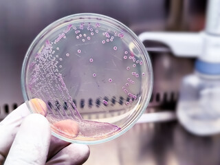 A microbiological culture Petri dish with a colonies of the pathogenic bacterium Escherichia coli (E. coli)