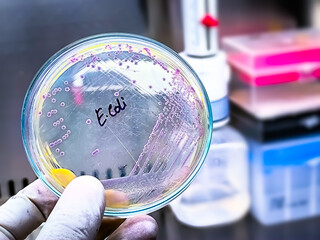 A microbiological culture Petri dish with a colonies of the pathogenic bacterium Escherichia coli (E. coli)