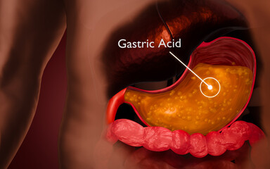 Human Stomach with Gastric Acid Highlighted in Digestive System Anatomy Illustration – 3D Rendering
