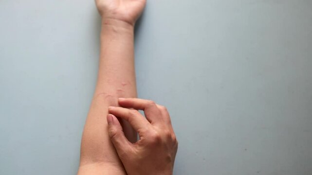 skin allergy female hand itches and rashes