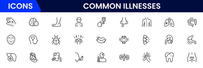 Common Illnesses line icons set. Common Illnesses outline icons with editable stroke collection. These Includes Breast Cancer, Depression, Brain Tumor, Allergy, Diabetes, and More.