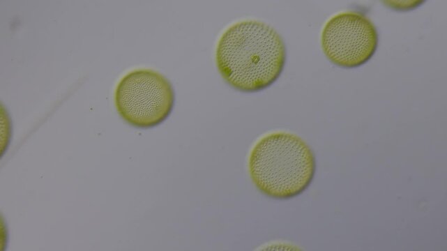 die s&uuml;&szlig;wasser alge volvox, eine kugelalge, als mikroskop video