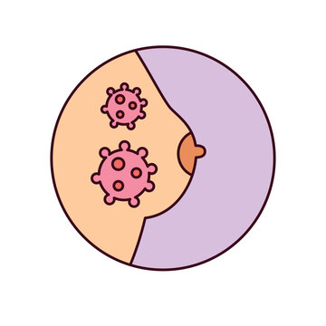Breast Cancer