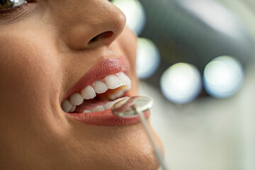Extreme closeup shot of young happy woman with white teeth having checkup 