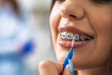 Closeup shot of young woman using interdental brush for cleaning her braces 