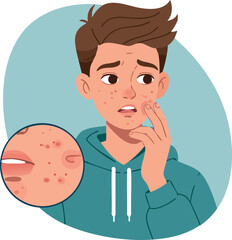 Teenager worried about acne skin problem with closeup of red pimples on face vector illustration 