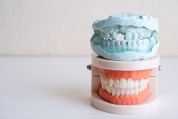 Dental Model and Plaster Cast of Human Teeth