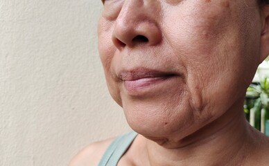 portrait the Flabbiness and wrinkle, smile lines and scar beside the mouth, dark spots and blemish, freckles and Flabby skin on the face, health care and beauty concept.