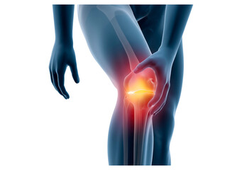 X-ray view of knee joint pain with highlighted inflammation on transparent background, PNG
