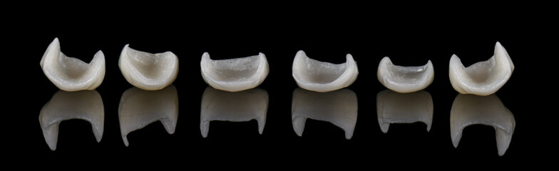 ceramic crowns and veneers