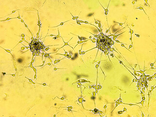 Spheroids of glioblastoma cell culture.
