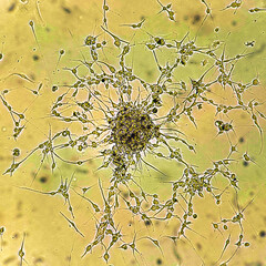 Spheroids of glioblastoma cell culture.