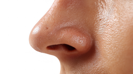 Close up of a runny nose with transparent background, highlighting the symptoms of rhinitis, flu, or common cold, potentially indicating a need for medical attention