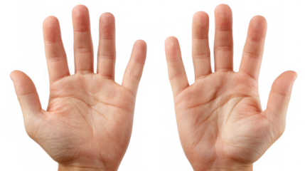 Two open hands with palms facing forward are presented against a transparent background, showcasing skin texture and lines with fingers extended