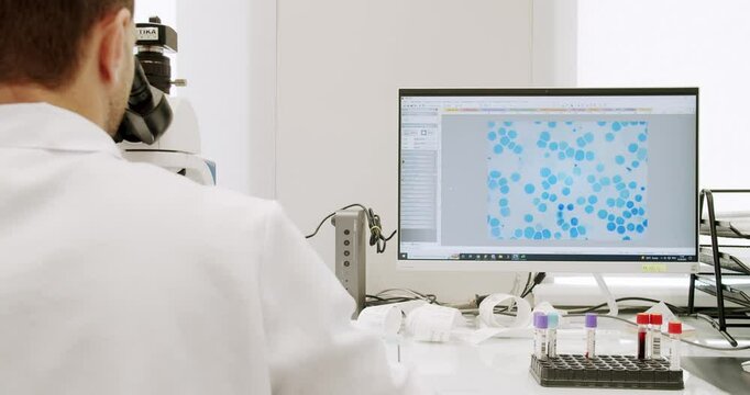 Male doctor using microscope in laboratory. Man in lab Using a microscope to examine the patients blood health condition. Examining blood under the high-tech microscope equipment. Medical device.