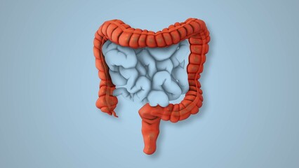 Irritable Bowel Triggers Causing Pain and Bloating