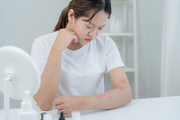 skin problem and beauty. Young woman scratch body has itchy skin from skin allergic, steroid allergy, sensitive skin, red from sunburn, chemical allergy, rash, insect bites, Seborrheic Dermatitis.