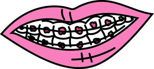 braces on teeth vector illustration for dental care, hygiene clinic, education poster, or oral health icon set