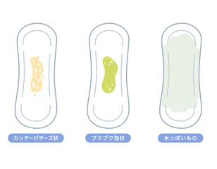 女性の健康　おりものの色の種類　ナプキン