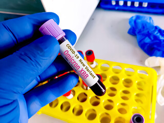 Covid-19 virus, blood sample for new omicron L.X.7 and XBB variant test. merged KS.1.1 and KP.3.3