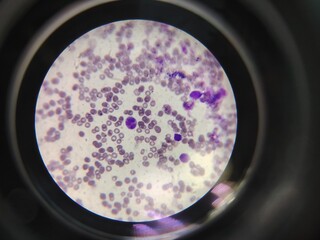 cells under a microscope, inflammation, cancer, neutrophils, macrophages