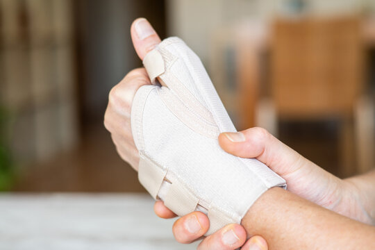 Close-up of a hand wearing an orthopedic brace, providing support and pain relief for conditions like rhizarthrosis, a degenerative joint disease affecting the base of the thumb
