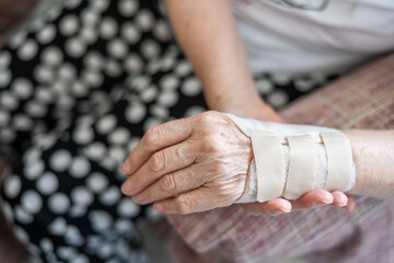 Close-up of a senior woman's hand, showcasing a wrist brace supporting an injured wrist, highlighting the effects of rhizarthrosis and degenerative joint disease