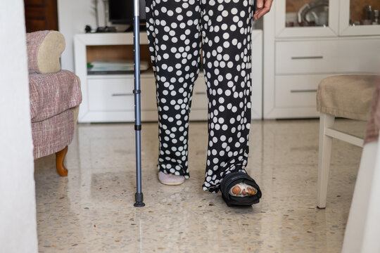 Senior woman, navigating her home with crutches and a walking cast after undergoing foot surgery, embodying the journey of rehabilitation and recovery