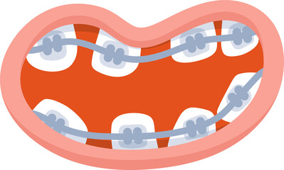 Treatment diastema teeth with braces cartoon illustration.