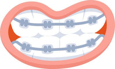 Braces teeth cartoon illustration.