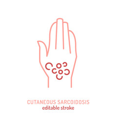 Obraz premium Cutaneous sarcoidosis icon, pictogram. Editable vector illustration