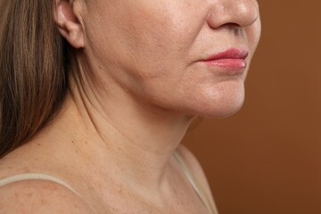 Fototapeta premium Woman before cosmetic procedure on brown background, closeup