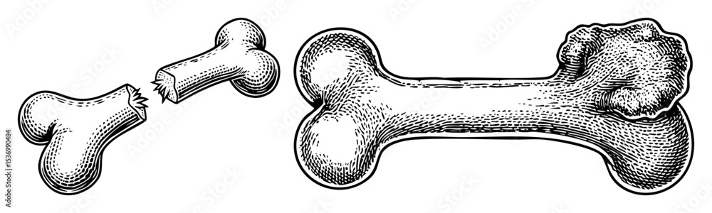 Aufkleber vector broken bone depicts a fractured skeletal structure.