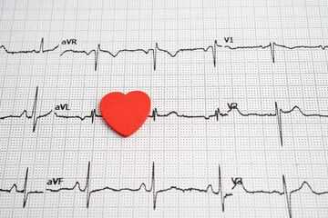 Electrocardiogram ECG heart wave, heart attack, cardiogram report.