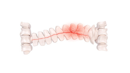 Spinal Cord Injury: Depicting damage and inflammation in the spinal column, highlighting the impact on the delicate nerve structure. Emphasizes the need for medical attention.