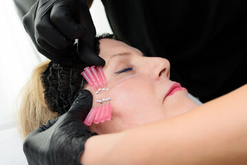 Beautician applying thread lift treatment on woman's face