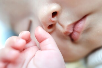 鼻に自分の爪でつけた引っ掻き傷がある赤ちゃん