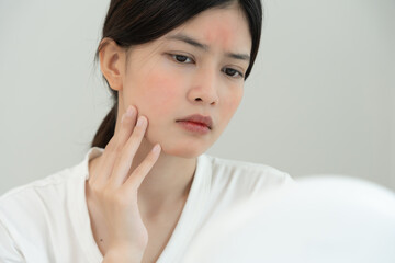 Young woman are worried about faces Dermatology and allergic to steroids in cosmetics. sensitive...