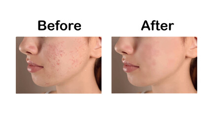 Skin Repair Treatment for Healthy Glowing Skin – Beauty and Skincare Concept