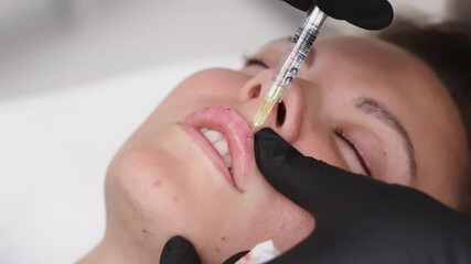  The cosmetologist slowly and carefully injects filler into the client’s lips. Injection procedure for lip augmentation, close-up. Advertising concept for facial care, youth and beauty.  - Powered by Adobe