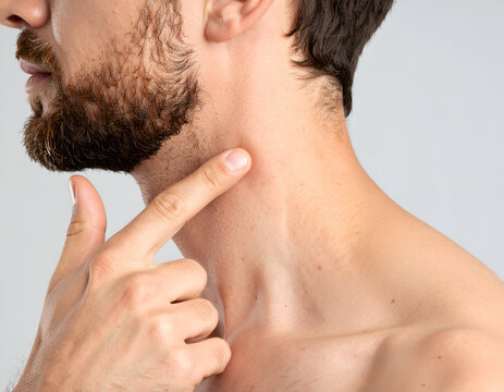 Close-up of swollen lymph node area on a young adult's neck, medical pointing hand