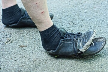 pair of black  torn old lace up sport rubber sole stylish dirty mens with hole sneakers worn on feet of man with socks on asphalt daytime outdoors