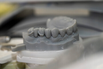 base de cire pour fabrication d'un appareil dentaire, modélisation en cire