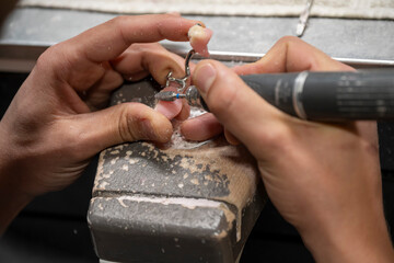 mains d'un technicien fabriquant un appareil dentaire sur une stellite