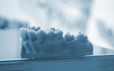 Prototype of human jaw gums and teeth printed on 3D printer from hardened rubber. Model of human lower gum with teeth created on 3D printer from hardened rubber under influence of ultraviolet light.