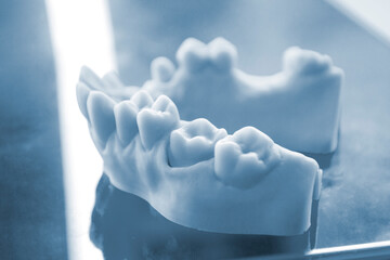 Prototype of human jaw gums and teeth printed on 3D printer from hardened rubber. Model of human lower gum with teeth created on 3D printer from hardened rubber under influence of ultraviolet light.